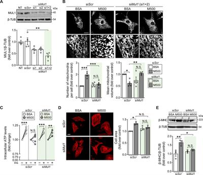 Myristate induces mitochondrial fragmentation and cardiomyocyte hypertrophy through mitochondrial E3 ubiquitin ligase MUL1